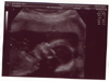 Our second daughter's head (at 20 weeks)